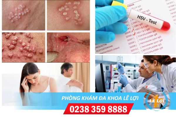 Mụn nước vùng kín là bị bệnh gì?