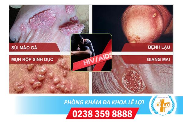 Mụn cơm hoa liễu là bệnh gì?