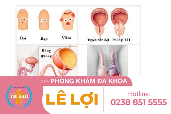 Khám nam khoa để bảo vệ sinh lý và sinh sản ở nam giới