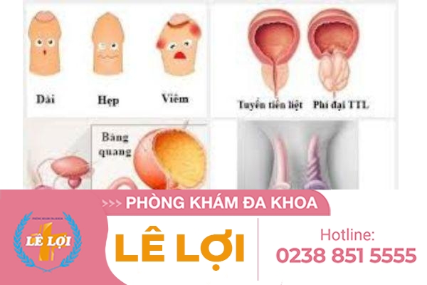 benh-sinh-duc-nam-va-nhung-dieu-can-biet-4