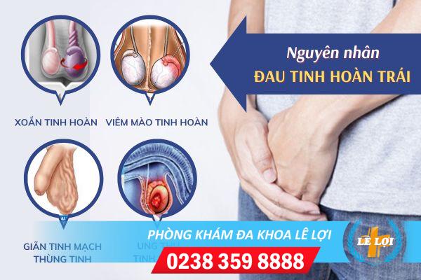 Bị đau tinh hoàn trái: cẩn thận với triệu chứng nguy hiểm này