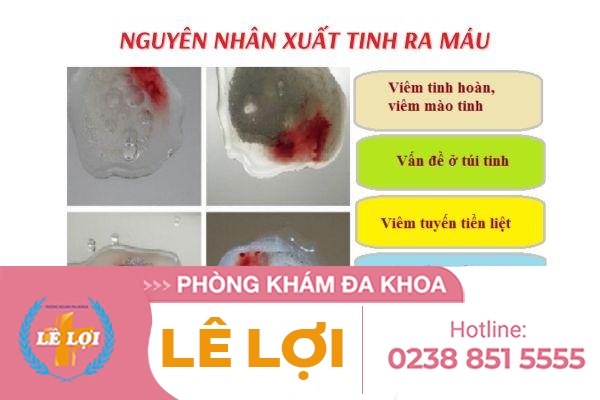 can-can-than-voi-chung-xuat-tinh-ra-mau-rat-nguy-hiem-5