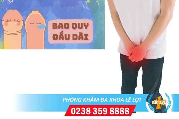 Bạn có biết dài bao quy đầu và nam giới có nên cắt bao quy đầu bị dài không?