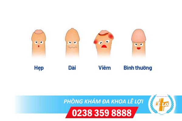 Những tác hại của dài bao quy đầu ở nam giới?