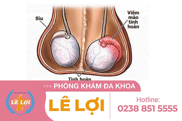 dau-duong-vat-do-benh-tinh-hoan