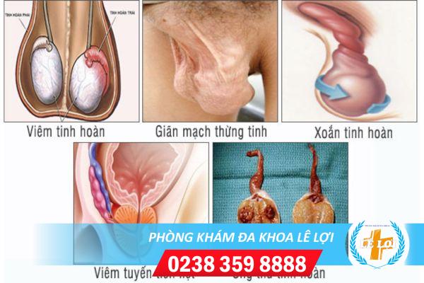 dau-mot-ben-tinh-hoan-can-than-voi-cac-trieu-chung-nguy-hiem-nay-5