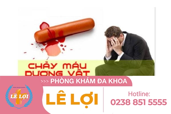 Tại sao nam giới lại bị dương vật chảy máu?
