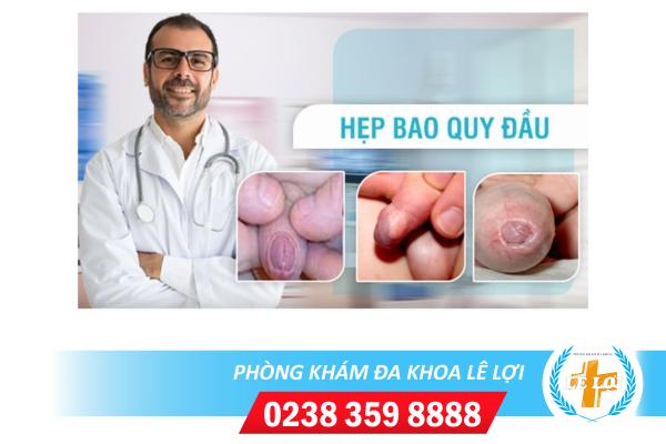 Các dấu hiệu hẹp bao quy đầu ở nam giới không nên chủ quan