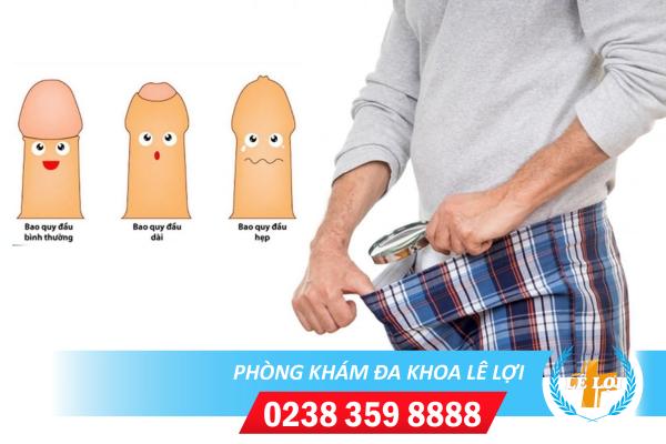 Những cách hỗ trợ chữa hẹp bao quy đầu hiệu quả cho nam giới