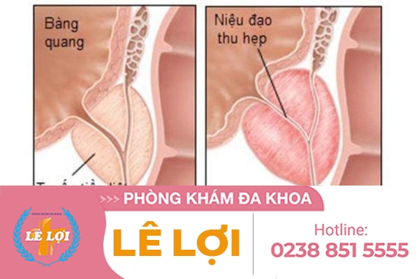 hien-tuong-xuat-tinh-muon-la-gi-va-cach-ho-tro-dieu-tri-the-nao-5