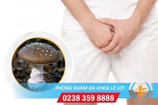 Nấm bao quy đầu có nguy hiểm không và cách xử lý hiệu quả
