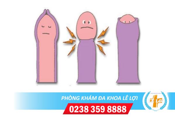 Nghẹt bao quy đầu nguy hiểm như thế nào?