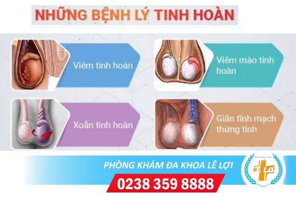 nhung-kien-thuc-can-biet-ve-cac-can-benh-o-tinh-hoan-1