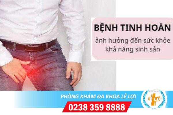 Những kiến thức cần biết về các căn bệnh ở tinh hoàn