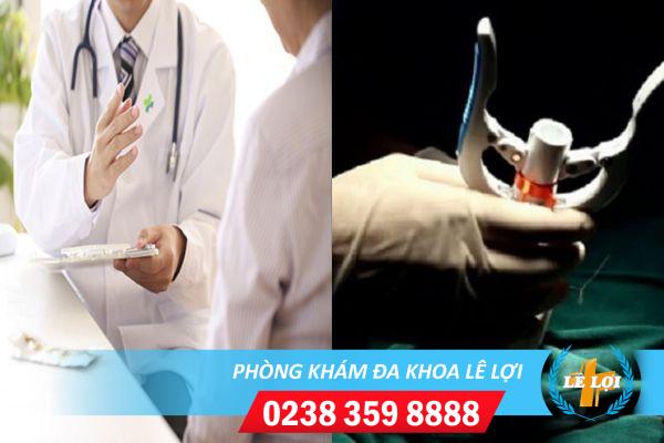 Những kiến thức cần thiết về thủ thuật cắt bao quy đầu