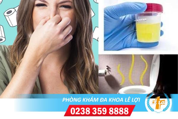 Nguyên nhân nước tiểu có mùi hôi và phương pháp hỗ trợ điều trị