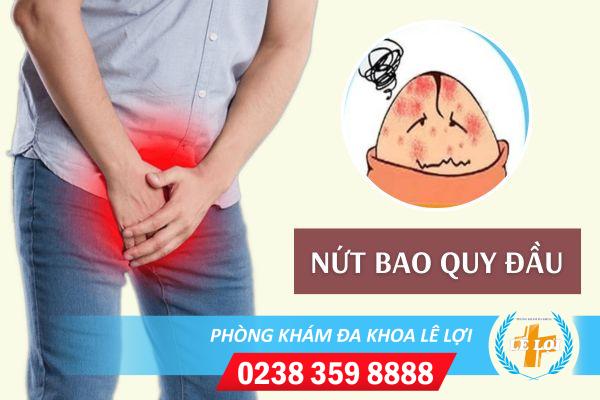Nứt da quy đầu do đâu? Dấu hiệu và phương pháp hỗ trợ điều trị