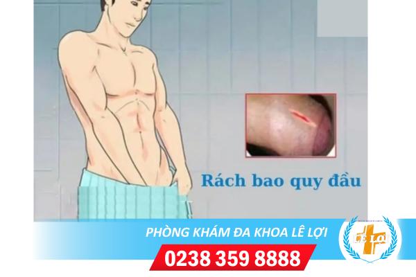 Khi bị rách bao quy đầu cần xử lý thế nào?