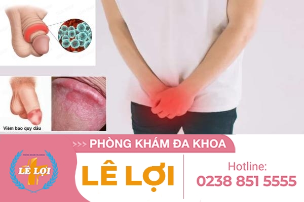 Bạn có biết bị sưng dương vật là bệnh gì và phương pháp xử lý