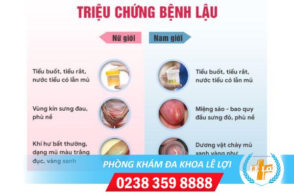 tieu-thuong-xuyen-tieu-nhieu-lan-trong-ngay-trieu-chung-khong-the-xem-thuong-3