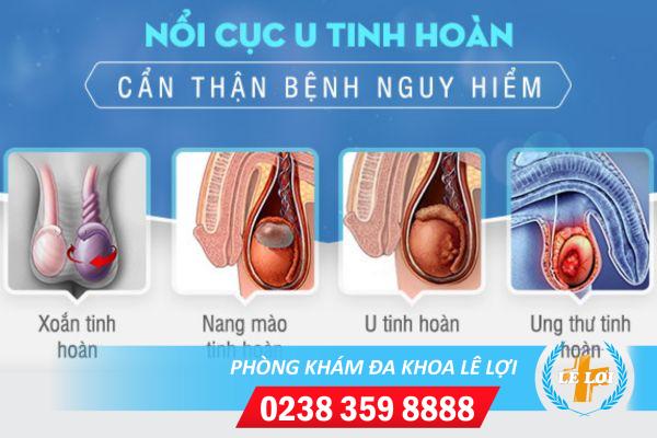 tinh-hoan-noi-cuc-la-bi-benh-gi-6