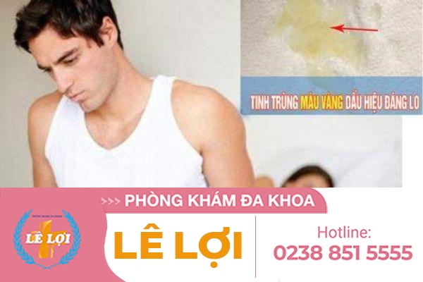 Tinh trùng màu vàng và các biến chứng nguy hiểm