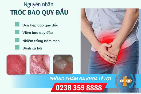 troc-da-quy-dau-phai-lam-sao-de-chua-tri-4