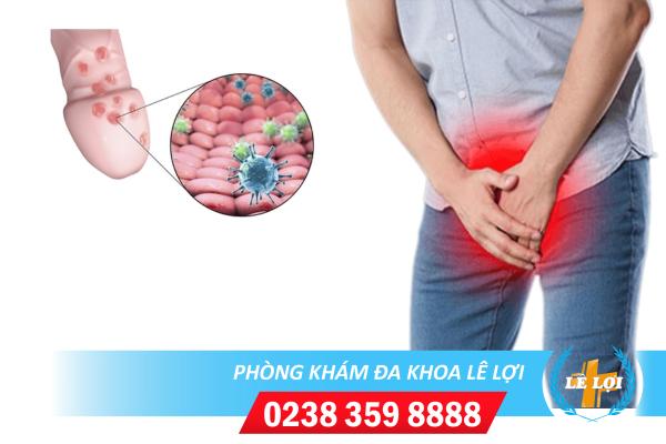 Một số bệnh viêm nam khoa nam giới thường hay gặp và dễ mắc phải