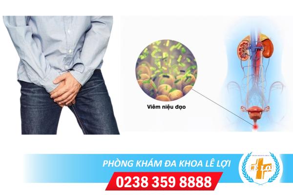 Viêm niệu đạo và những kiến thức cần biết