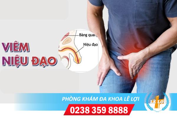 Các giải pháp hỗ trợ chữa viêm niệu đạo hiệu quả