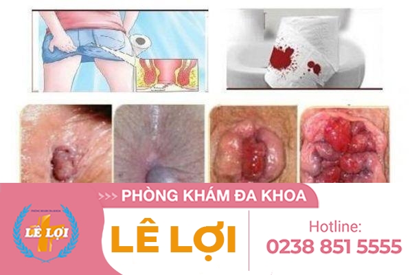 cat-tri-bang-phuong-phap-nao-hieu-qua-an-toan