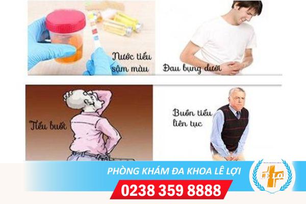Biểu hiện viêm đường tiết niệu và cách điều trị