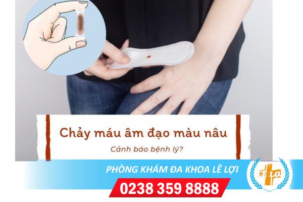 Chảy máu màu nâu là bị bệnh gì?
