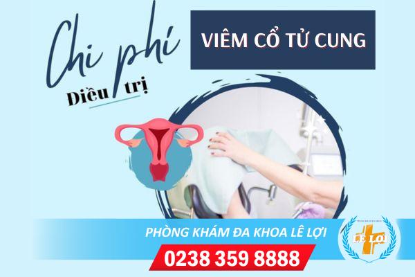 Chi phí chữa viêm cổ tử cung hết bao nhiêu tiền?