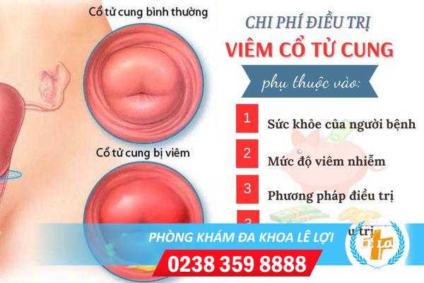 chi-phi-chua-viem-co-tu-cung-het-bao-nhieu-tien