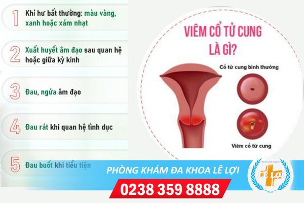 dia-chi-kham-viem-co-tu-cung-hieu-qua-uy-tin