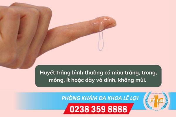 Huyết trắng bình thường có màu gì?