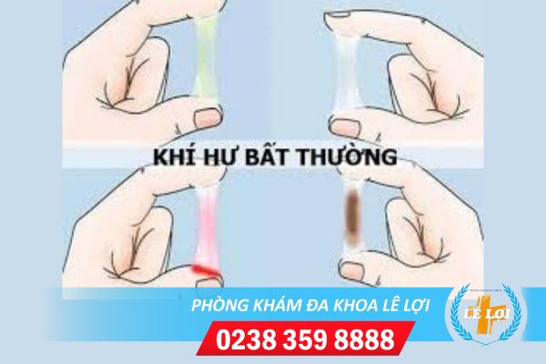 Khí hư có màu và mùi bất thường cảnh báo bệnh gì?