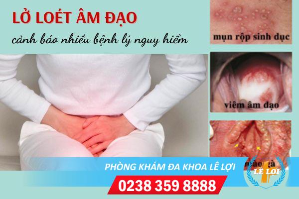 loet-am-dao-la-benh-gi-nguy-hiem-khong-1