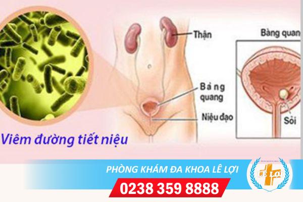 nguyen-nhan-viem-duong-tiet-nieu-2 (2)