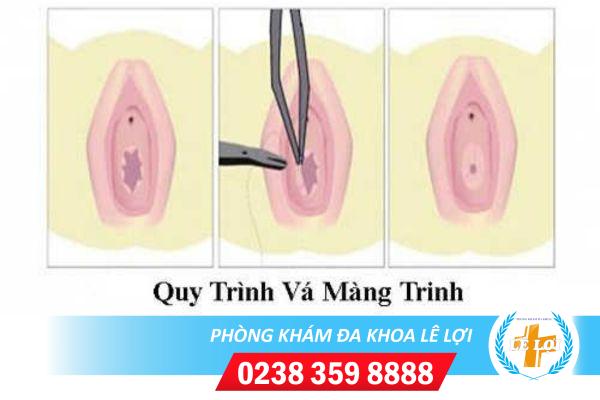 phau-thuat-va-mang-trinh-dep-tu-nhien-cong-nghe-han-quoc-1