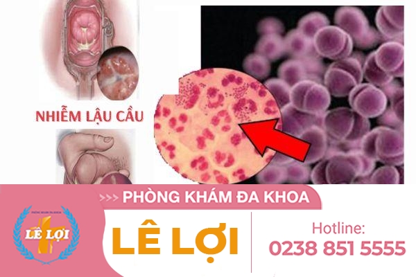 phong-kham-chua-benh-lau-uy-tin-tai-vinh-nghe-an-1 (2)