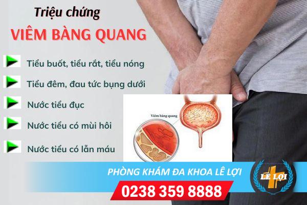 Bệnh viên bàn quan và những kiến thức cần biết