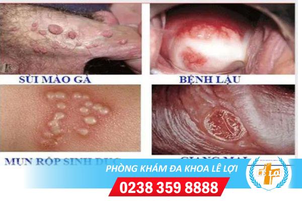 cach-chua-tri-benh-xa-hoi-an-toan-hieu-qua-3