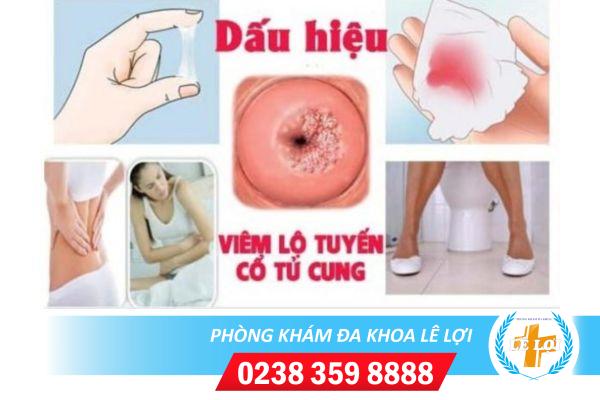 Dấu hiệu và cách điều trị viêm cổ tử cung