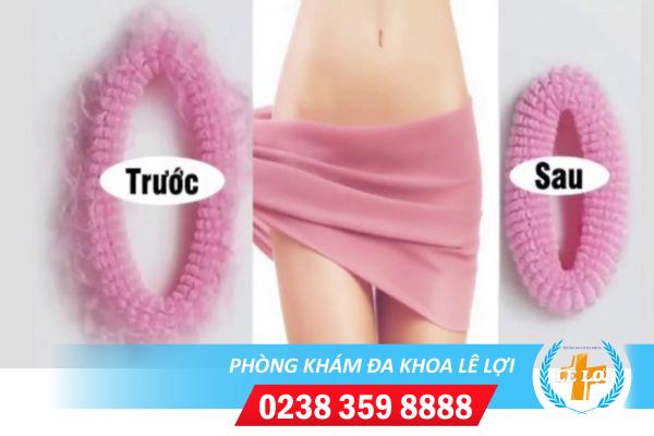 Bật mí cho bạn cách khắc phục âm đạo rộng siêu hiệu nghiệm