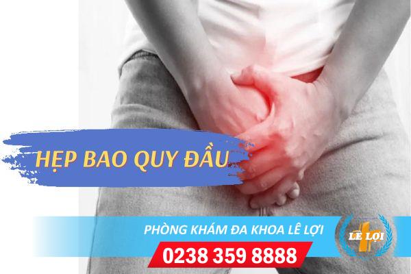 Hẹp bao quy đầu là gì và cách điều trị hiệu quả