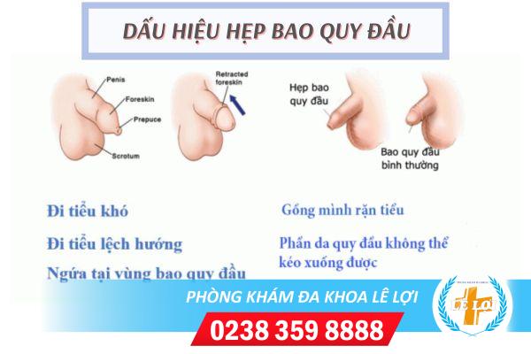 hep-bao-quy-dau-la-gi-va-cach-dieu-tri-hieu-qua