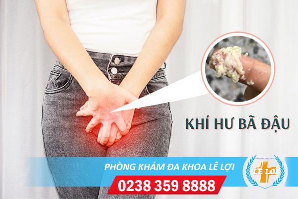 Khí hư bã đậu là dấu hiệu bệnh gì?