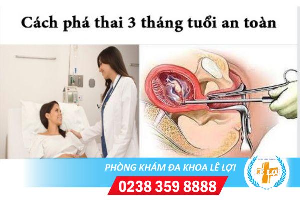 Phá thai 3 tháng trở lên bằng cách nào?